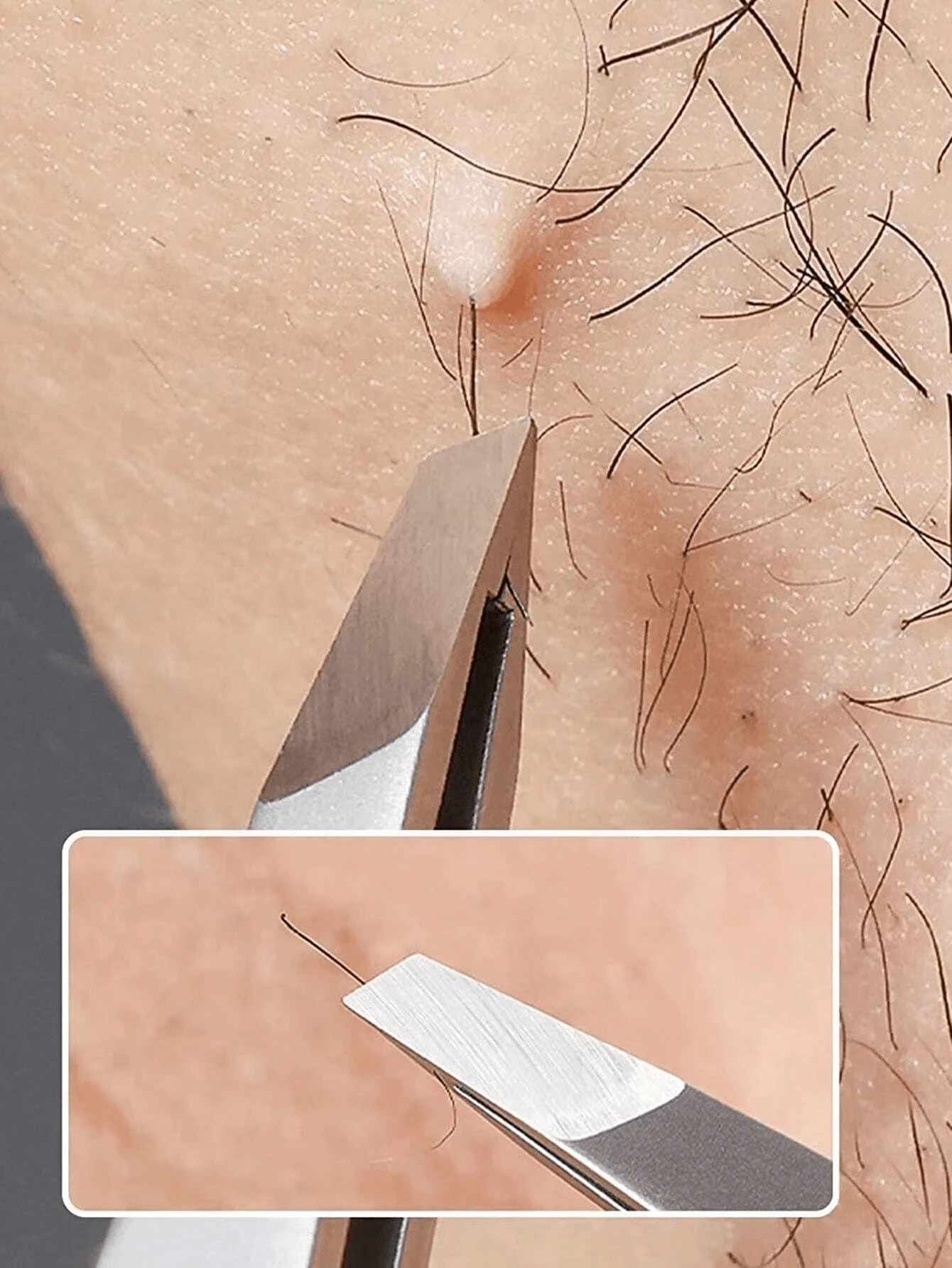 1pc Stainless Steel Tweezer Set - Includes 1 Tweezer For Removing Facial Hair, Ingrown Hair And Debris, And 1 Eyebrow Tweezer - Professional Hair Removal Tweezers