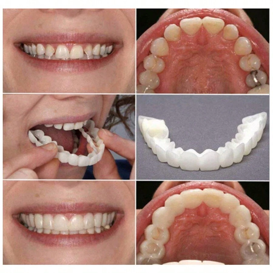 2 pezzi Apparecchi ortodontici dal colore naturale che aiutano a ottenere un sorriso perfetto, adatti per varie occasioni: per attività sociali, per diverse forme di denti, universali, facili da installare