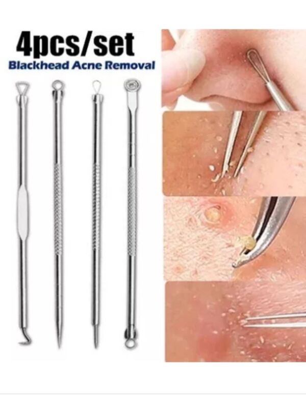 Kit 4 Ferramentas Tira Acne Cravos E Espinha Limpeza