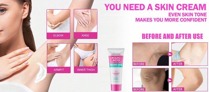 1pc Underarm Whitening Cream To Remove Underarm Darkness Underarms Knees Whitening Cream Underarm Whitening Cream With Plant Essence And Collagen Whitening Cream Moisturizing Moisturizing Cream Fade Dark Areas Of Skin  p 40605433