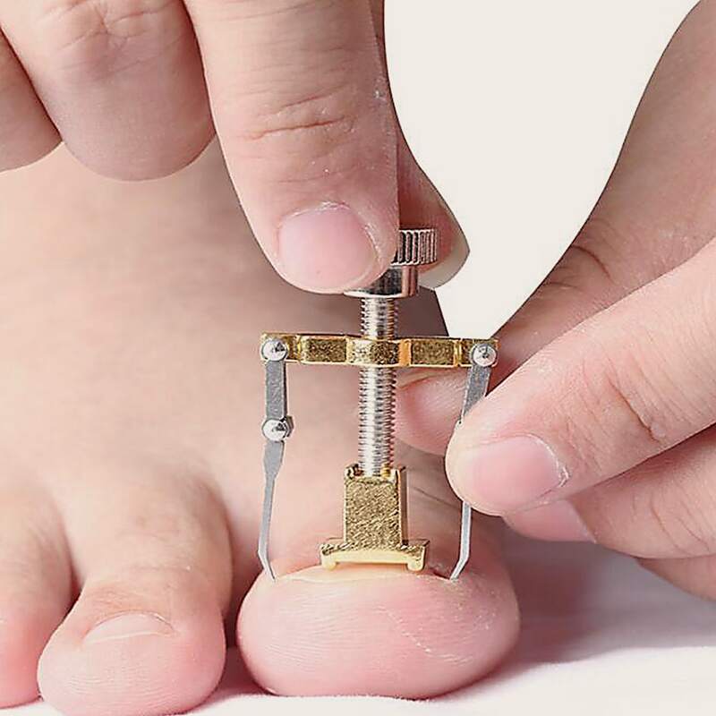 

Metallic Inlay Orthosis Manicure Nail Clippers