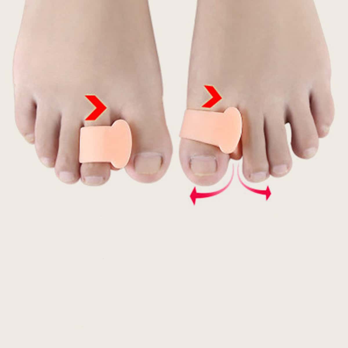 

2pcs Toe Eversion Appliance