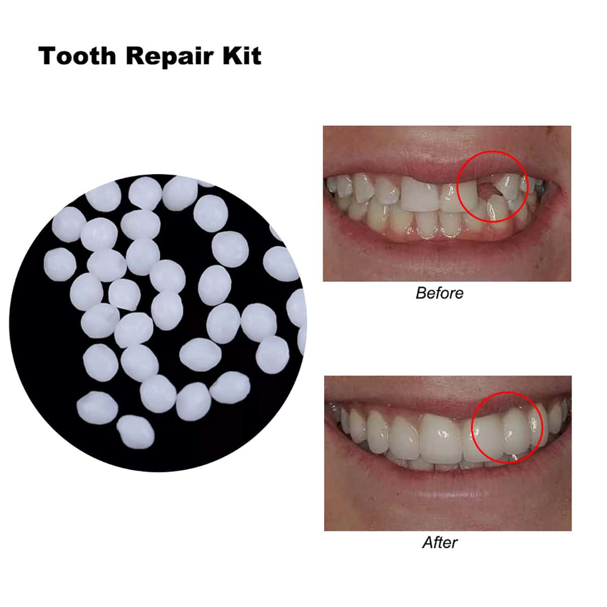 

Temporary Denture Adhesive Repair Kit, White