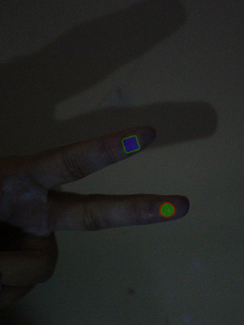 thumb