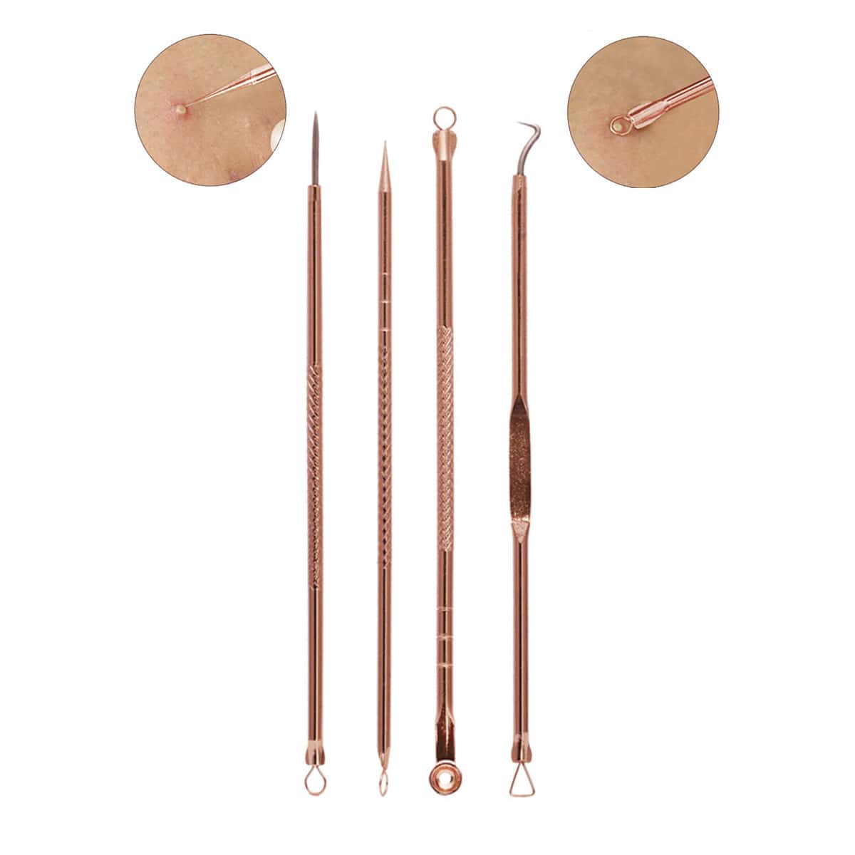 

4pcs Acne Needle Kit, Rose gold