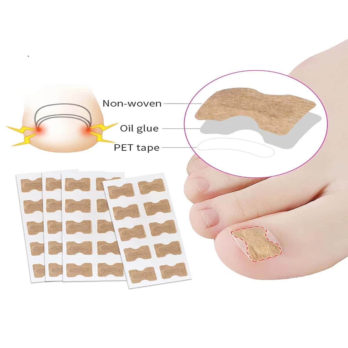 

20pcs Toenail Correction Sticker, Brown
