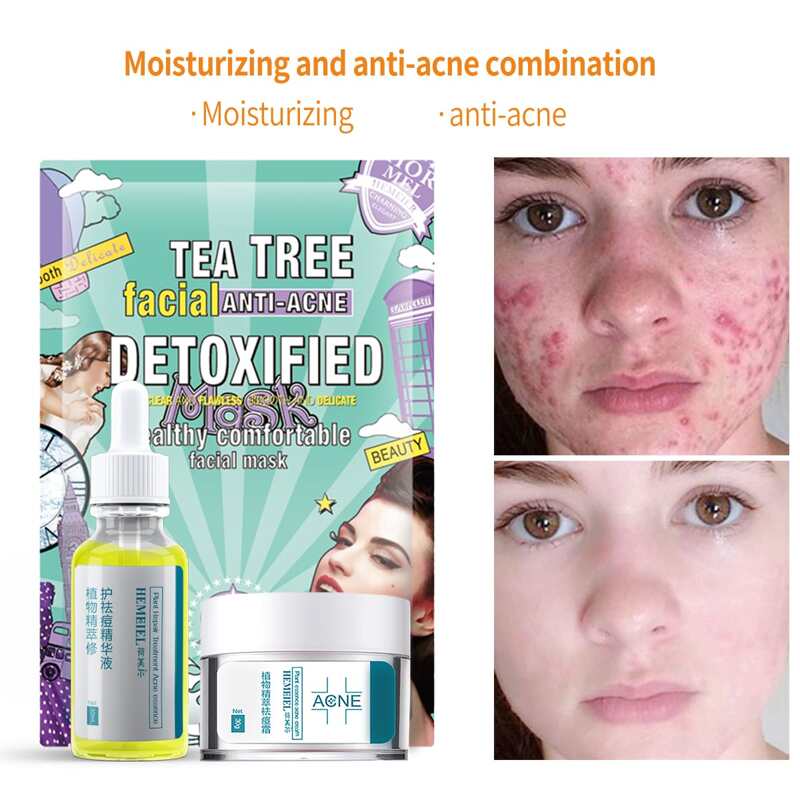 

1pc Acne Essence & 1pc Acne Cream & 3pcs Anti-acne Facial Sheet, White