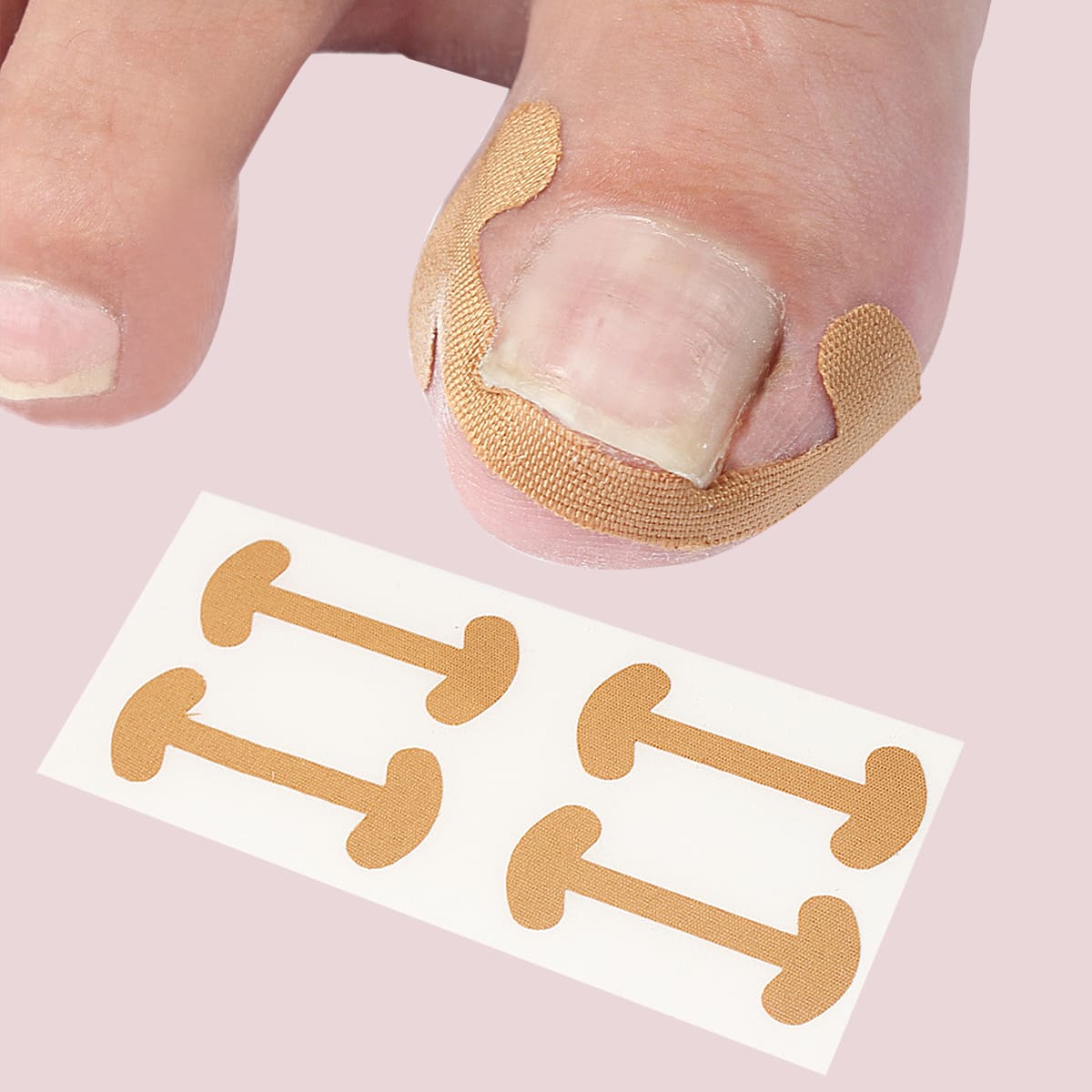 

5sheets Toenail Correction Sticker, Yellow