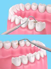 Stainless Steel Dental Pick - Rusty Rose - View 3