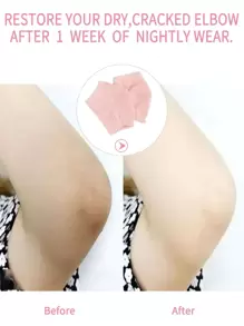 2pcs Essential Oil Moisturizing Elbow Pad - Baby Pink - View 4