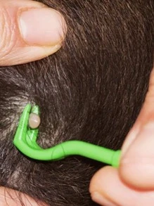 3PCS/Set Pet Flea Removal Tool Kit Plastic Scratching Hook Remover Cat Dog Grooming Supplies Tick Removal Tool Tweezers Clip - Green - View 2