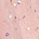 Coral Pink