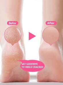 矽膠腳跟套，2入组防干腳跟保護器鰻魚保護套腳襪 - 白色 - 查看 8