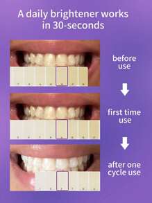 Hismile V34 色彩校正精华紫色牙齿美白牙齿清洁慕斯，强效牙齿亮白技术。 - 紫色 - 查看 4