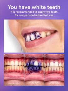 Hismile V34 色彩校正精华紫色牙齿美白牙齿清洁慕斯，强效牙齿亮白技术。 - 紫色 - 查看 5