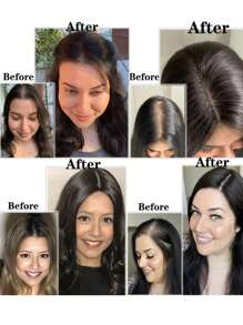 Straight Human Hair Topper Lace Base Hand Tied Hair Pieces For Hair Loss Toppers - Natural Black - View 5