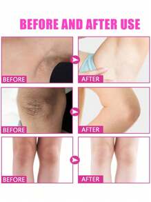 3支/2支/1支装腋下美白霜，去除腋下暗沉。适用于腋下、膝盖等部位，蕴含植物萃取精华和胶原蛋白。美白、保湿、滋养，淡化肌肤暗沉。 - 彩色 - 查看 4