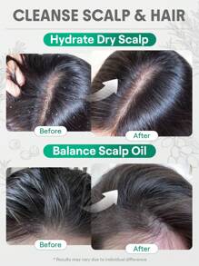 SHEGLAM HAIR Rosemary Hair And Scalp Oil -15ml/0.5Fl Oz,Hair Care Essential Oil,Rosemary Hydrating Oil Serum,Balance Scalp Sebum,Soothe Dry Scalp,Increase Shine & Elasticity,Nourish Hair Follicles,Enriched With Rosemary Oil,Macadamia Seed Oil And Grapeseed Oil Suitable For People With Sensitive Scalp And Dandruff Makeup Beach Y2k Travel Camping School Cosplay Gift Campus Fashion