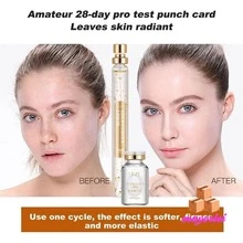 Juego de levantamiento de hilo de proteína de oro de seda, relleno facial, línea de colágeno absorbible, reafirmante, regordeta, antiarrugas, cuidado de la piel coreano - Dorado - Ver 8