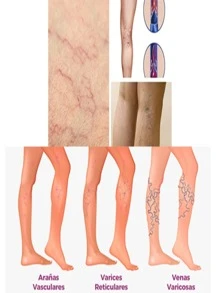 Crema de Castaña de Indias - Blanco - Ver 3