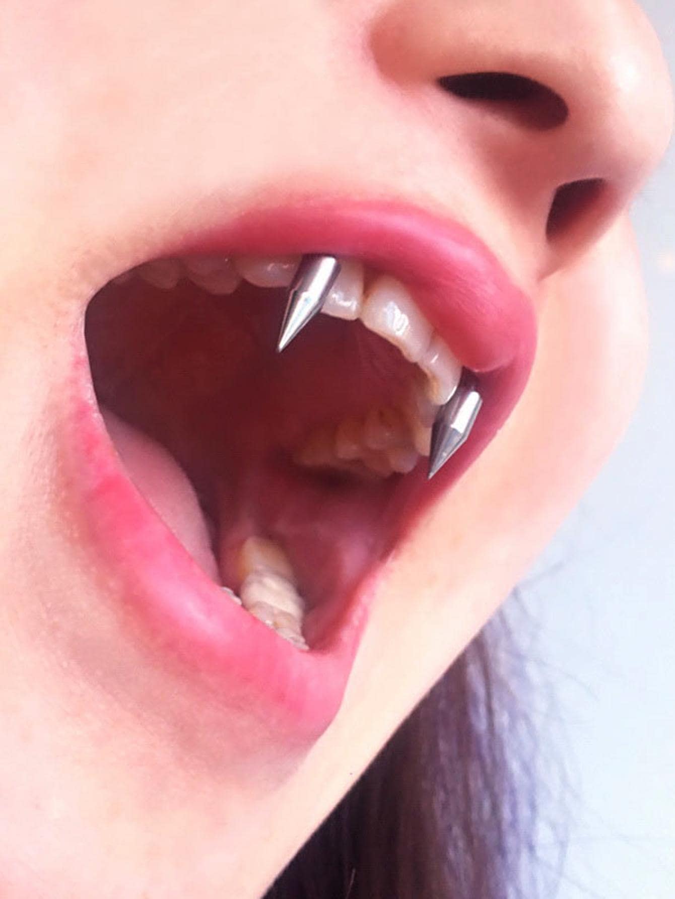 圓錐裝飾牙套飾品 - 銀色 - 查看 1