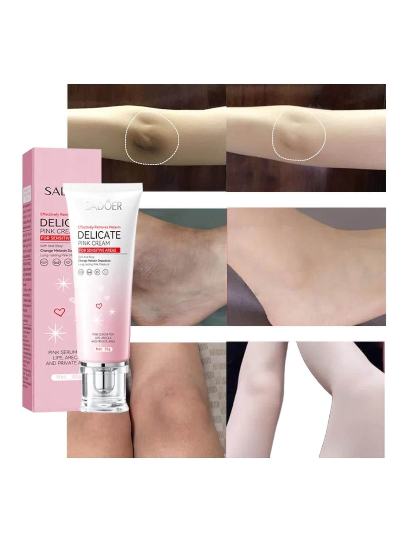 Crema Aclarante partes sensibles De Axilas Entrepierna Aclara Codos Rodillas - Blanco - Ver 1