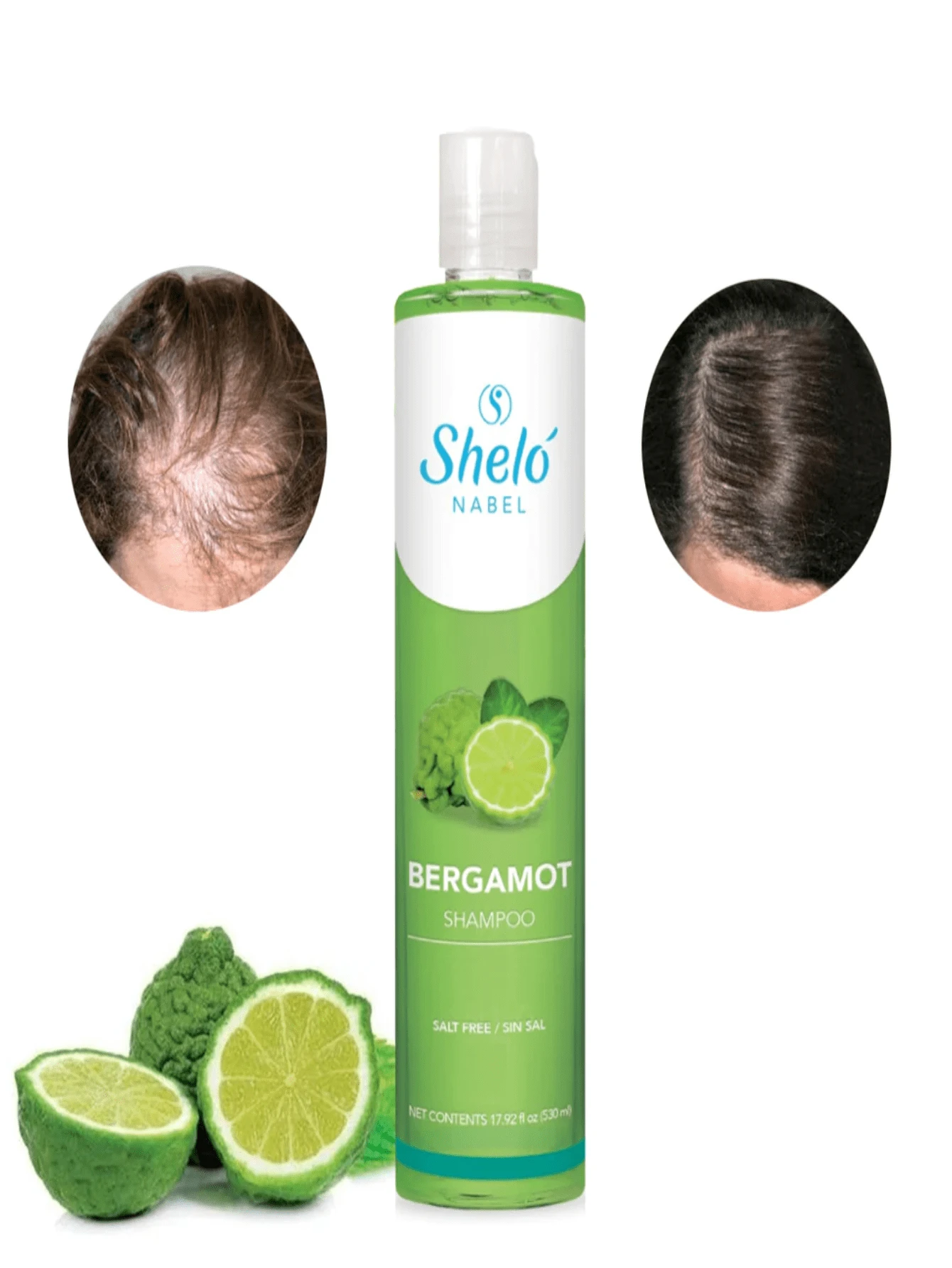 Shampoo de Bergamota con Minoxidil Moda de Mujer SHEIN México