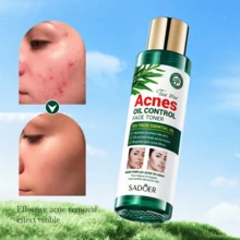TEA TREE ACNES FACE TONER - Green - View 3