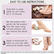 Foot Scrubber Pumice Stone For Removing Dead Skin & Callus On Feet - Blue - View 6