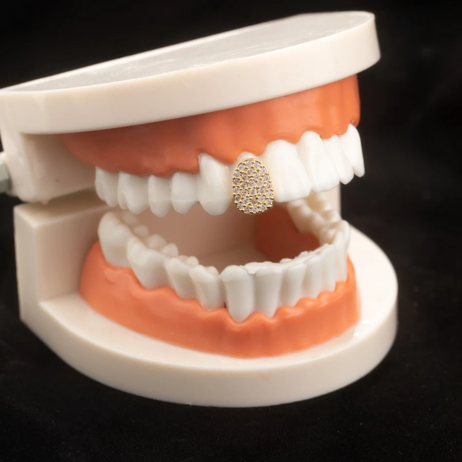 Đàn ông Zirconia trang trí niềng răng để trang trí hàng ngày cho một cái nhìn phong cách - Vàng - Xem 1