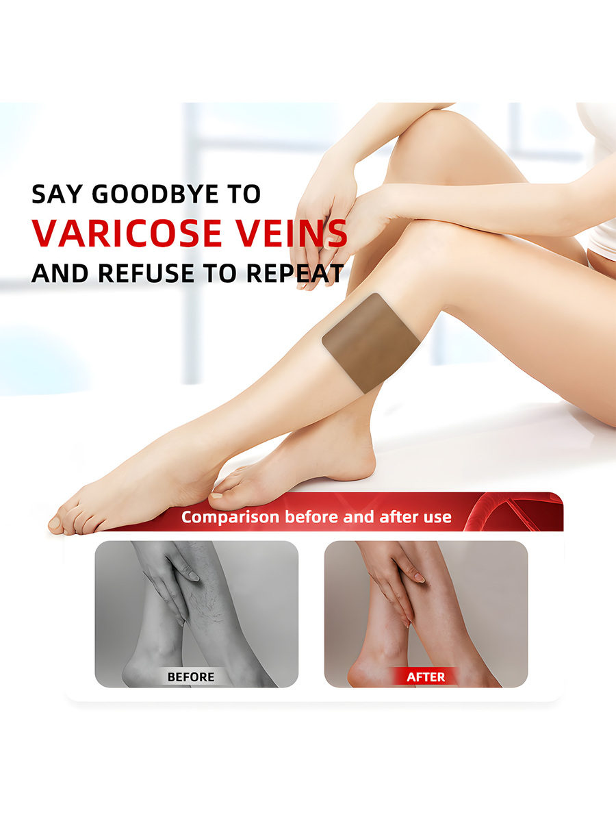 Varicose Veins Treatment Leg Heating Patch Strengthen Capillary Health And Improve Blood