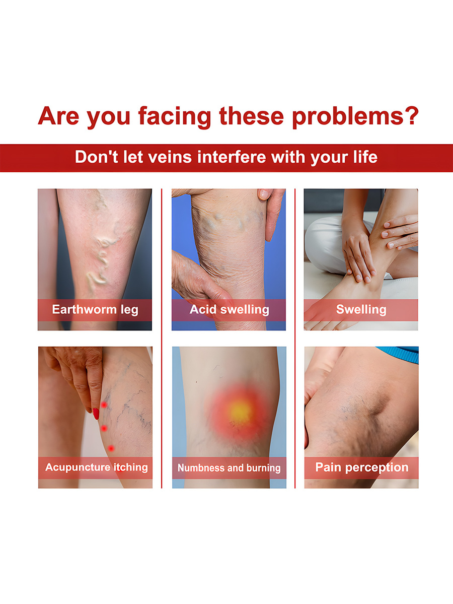 Varicose Veins Treatment Leg Heating Patch Strengthen Capillary Health And Improve Blood