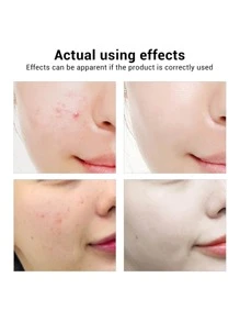 Serum Bioaqua Acido Hialuronico Anti-arrugas Hidratante 30ml - Blanco - Ver 2