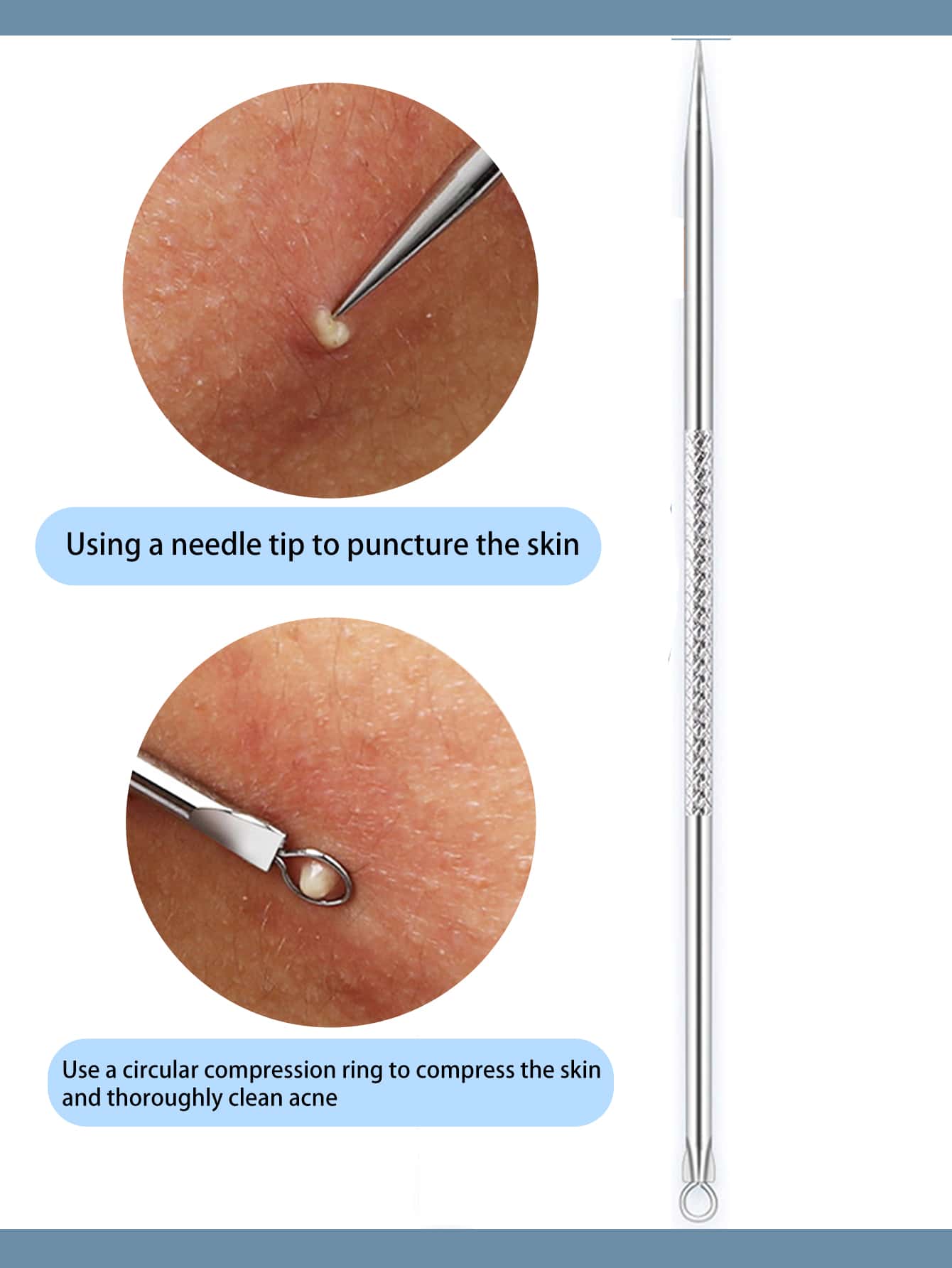 Pimple Popping With Needle
