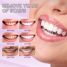 1入組紫色牙膏適用於牙齒美白,瓶按包括 - 紫色 - 查看 7