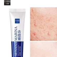 SENANA-Crema para el tratamiento del acné,  para eliminar la espinilla , crema antiacné para todo tipo de piel 30g - Azul - Ver 2