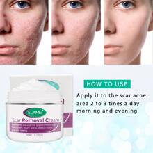 Scar Removal Cream 50ml - White - View 2