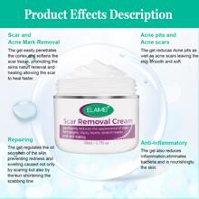 Scar Removal Cream 50ml - White - View 5
