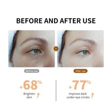 LANBENA Under Eye Patches - 30 Pairs Vitamin C Eye Mask- Puffy Eyes & Dark Circles Treatments, Reduce Under Eye Bags and Smooth Wrinkles - 橘色 - 查看 7