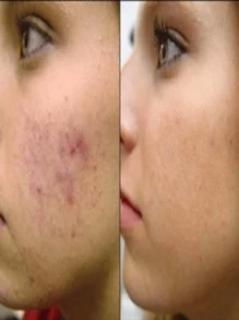 Concha Naca Lightening Cream 60 G