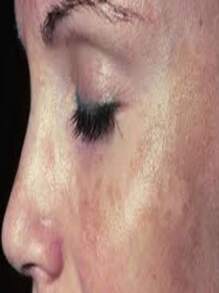 Concha Naca Lightening Cream 60 G