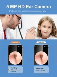 The Ultimate Ear Cleaning Kit-1080P Camera, Light, And Ear Wax Removal Tool Compatible With IPhone, Ipad, And Android Smartphones - White - View 4
