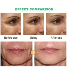 5秒除皺即時抗衰老面霜緊膚緊緻 - 白色 - 查看 6