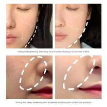 臉部按摩器和美容儀,用於皮膚緊緻和提升、臉部和頸部治療、皮膚護理工具家用臉部護理機 - 藍色 - 查看 6