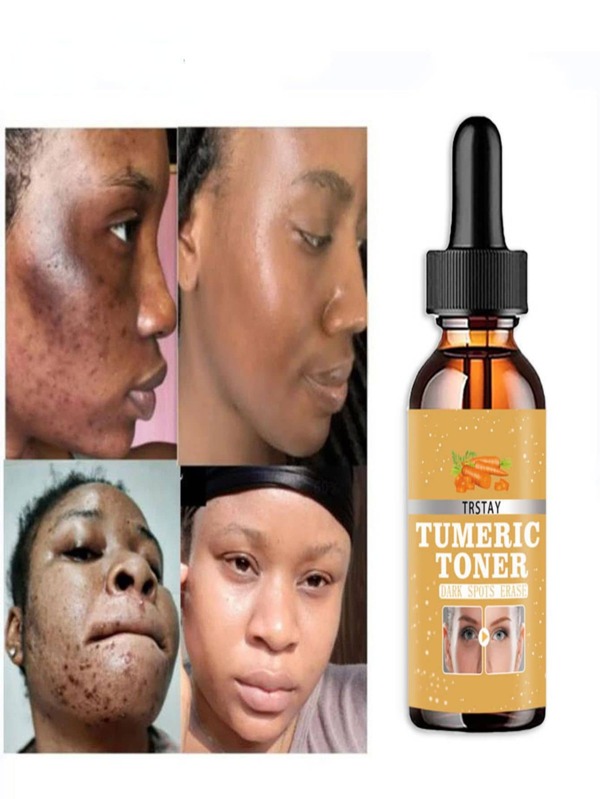 5ML/15ML/30ML/50ML/Turmeric Lemon Skin Glow Face Serum Acne Dark Spot Whitening Black Patches Melasma Corrector Brightening Essential Oil Skin Care