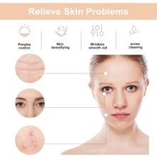 High Frequency Facial Machine - High Frequency Facial Wand, Device for Skin Care - Beige - View 4