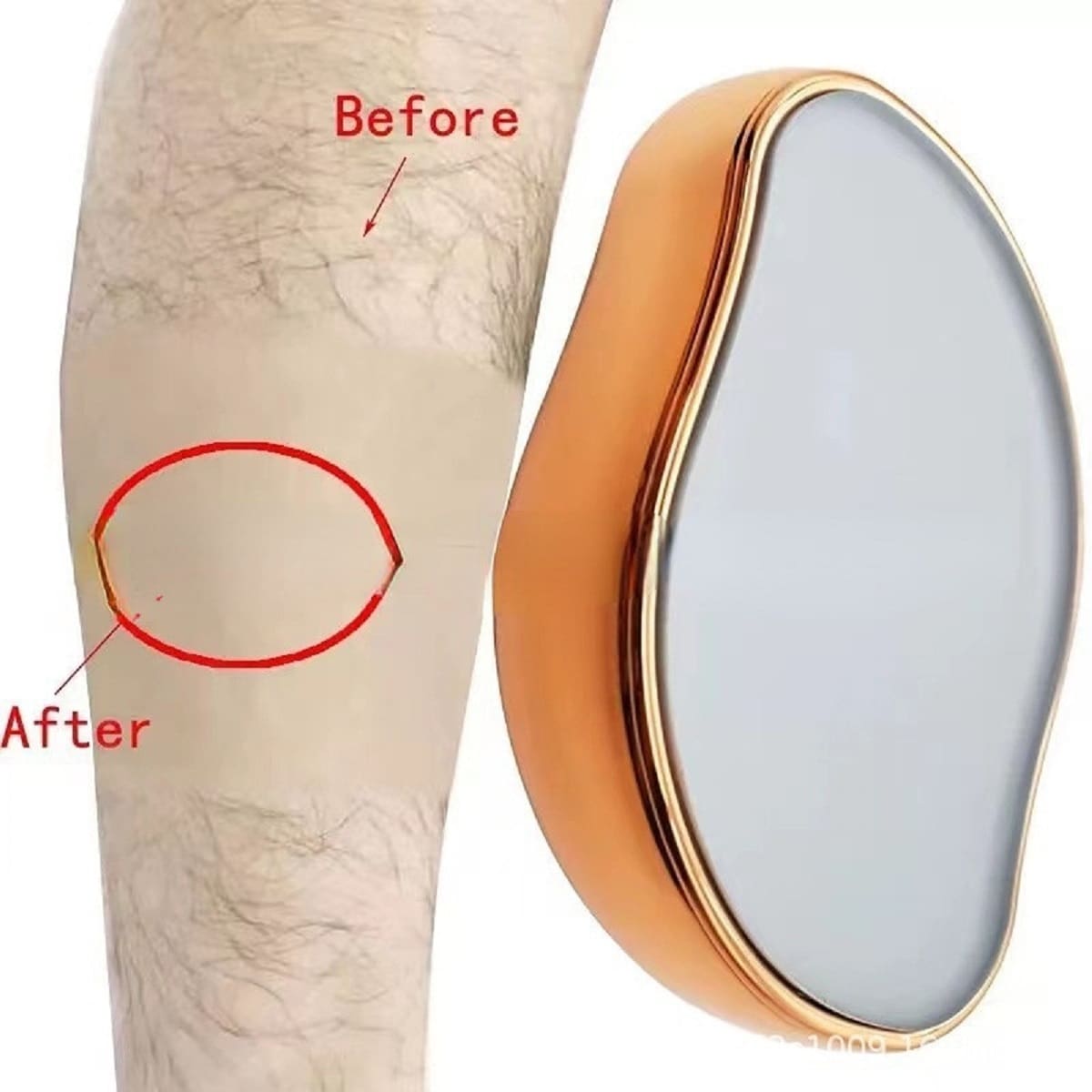 Epilator Hair Removal Device