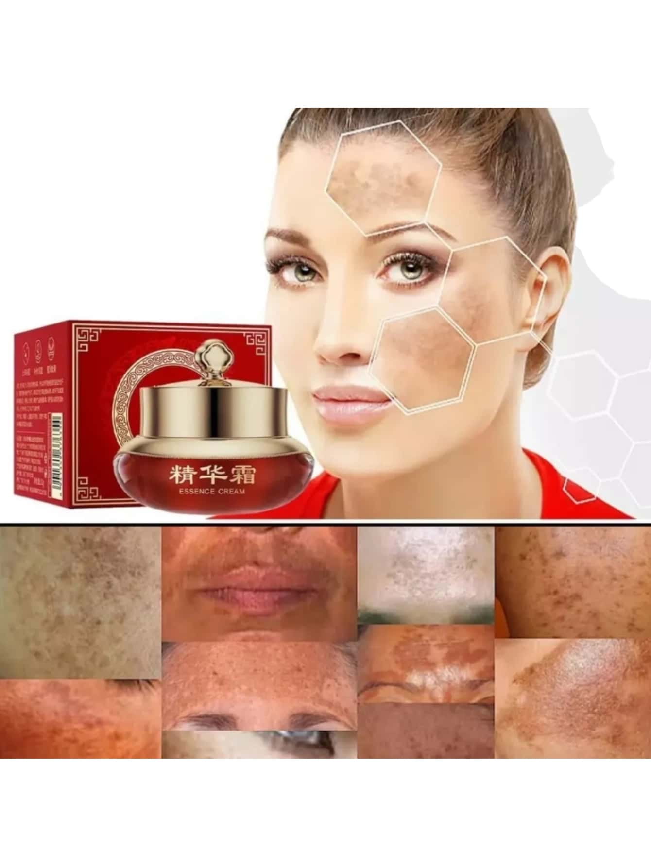 DRAGON'S BLOOD Cream Removes MELASMA Spots Anti-Aging Lightening Cloth - White - View 1