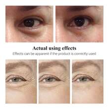 LANBENA HYALURONIC ACID EYE CREAM - Pure Natural Material Extraction - Puffy Eyes And Dark Circles Treatments – Reduce Wrinkles And Fine Lines Undereye, Improve And Firm Eye Skin - 藍色 - 查看 7