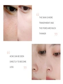 5ML/15ML/30ML/50ML/收縮毛孔面部精華液，嫩滑肌膚收縮毛孔精華液，解決肌膚問題 - 彩色 - 查看 5